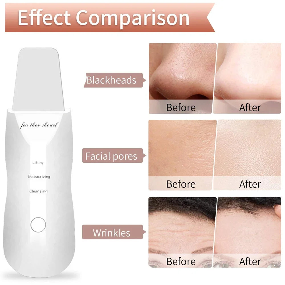 Limpiador Facial Ultrasónico
