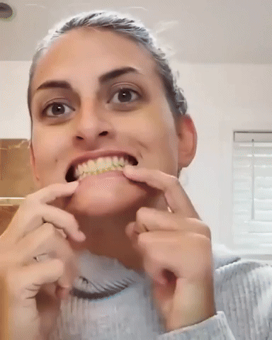 Sonrisa Radiante en Minutos