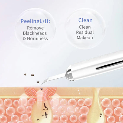 Limpiador Facial Ultrasónico